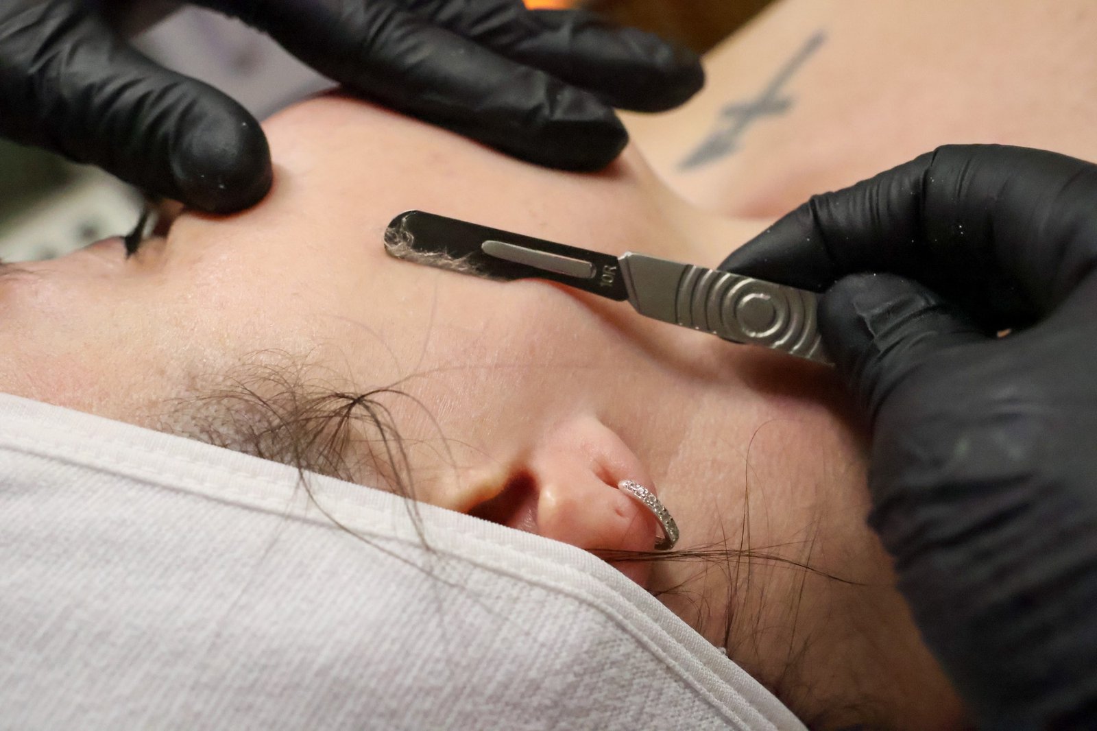 Close-up of a dermaplaning treatment